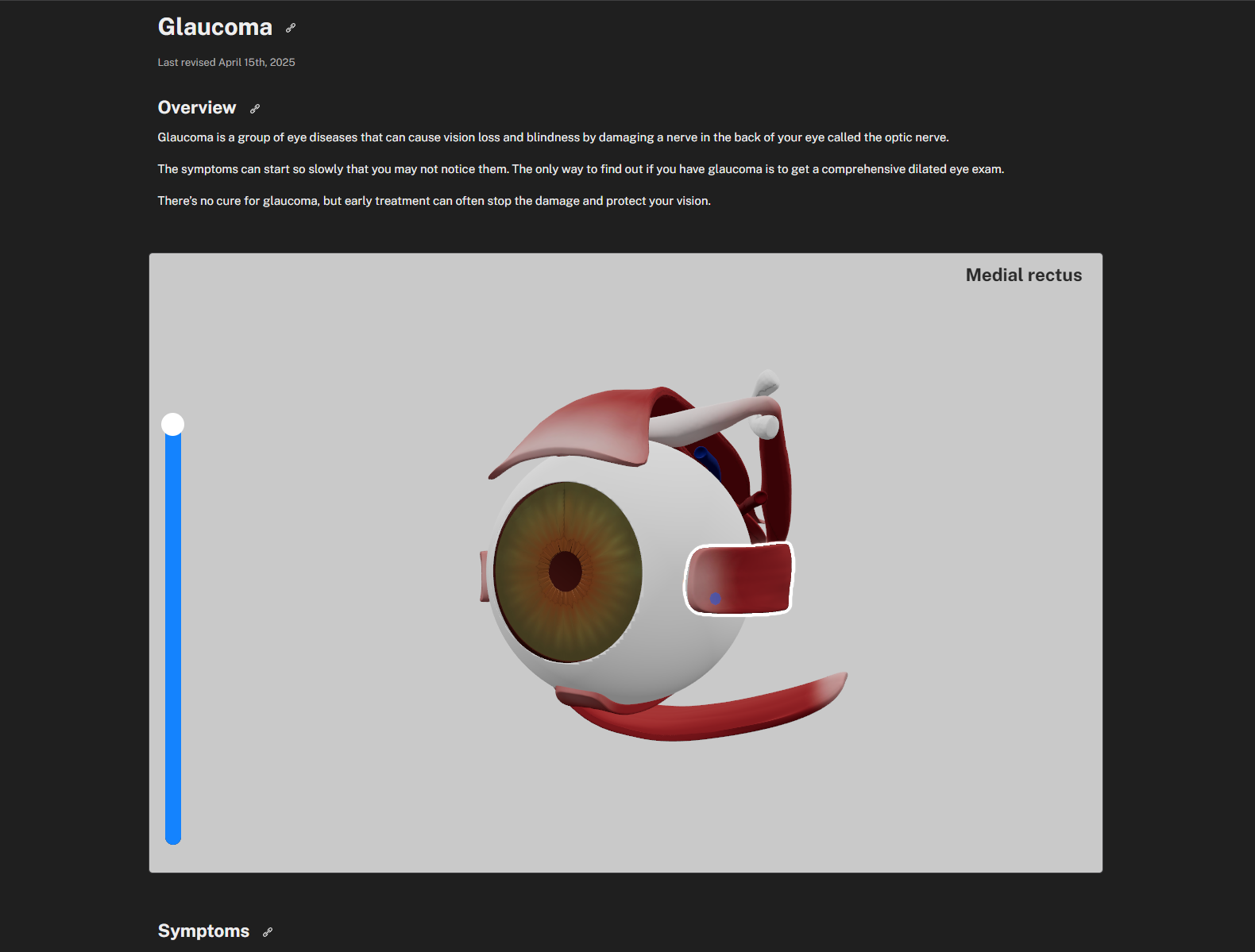 An example of a medical condition.